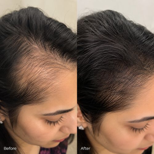 Crinora customer hair transformation