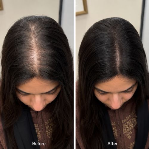 Crinora customer hair transformation
