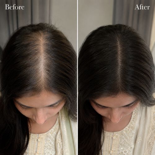 Crinora customer hair transformation