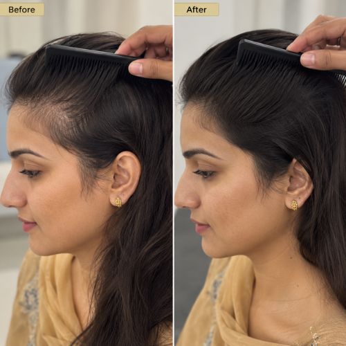 Crinora customer hair transformation