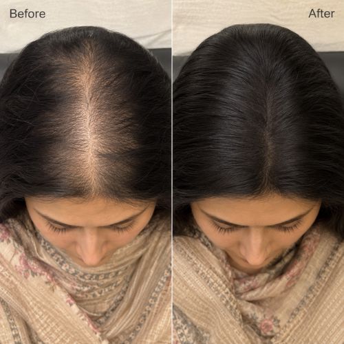 Crinora customer hair transformation