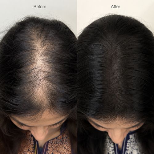 Crinora customer hair transformation