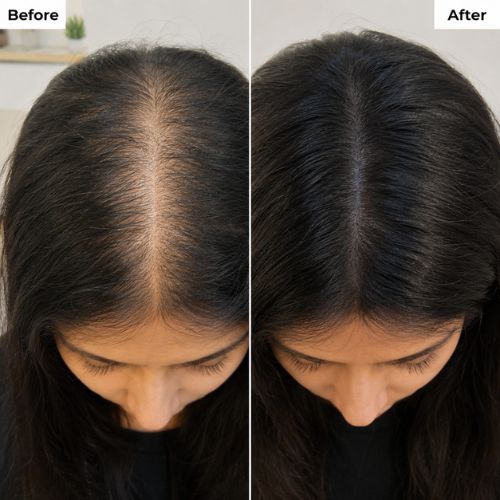 Crinora customer hair transformation